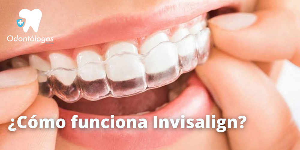 https://blog.odontologos.com.uy/wp-content/uploads/2022/02/Como-elegir-un-buen-cepillo-de-dientes-3.png