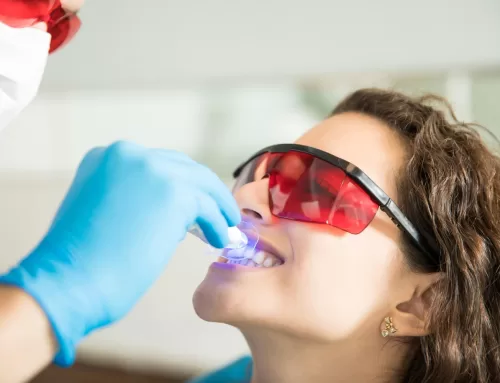 ¡Blanqueamiento dental en Uruguay! Descubrí cómo lograr una sonrisa más blanca y saludable